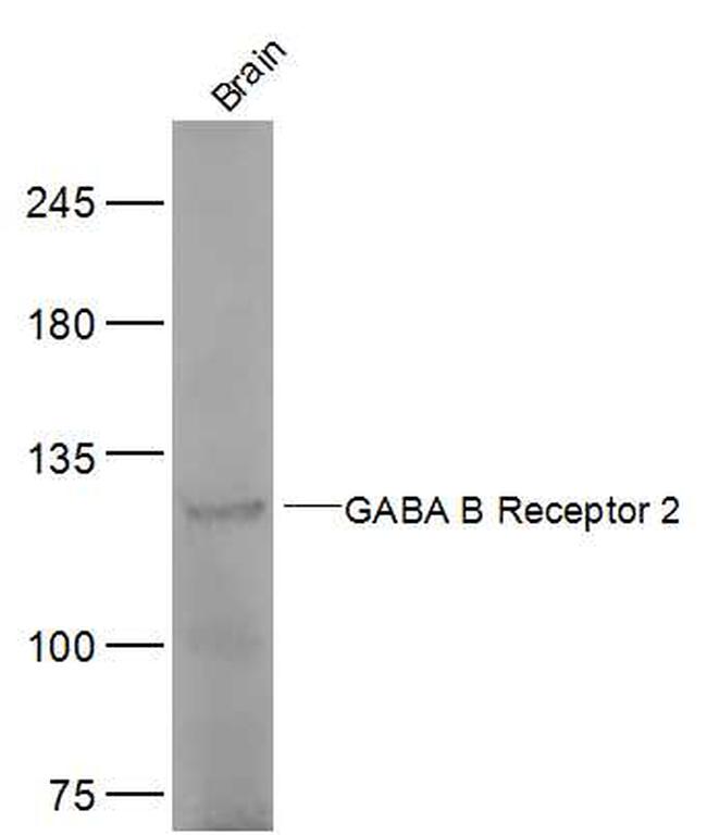 GABA B Receptor 2 Antibody in Western Blot (WB)