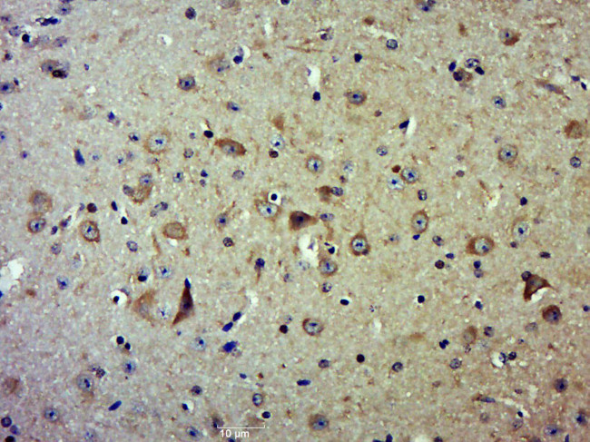 CSK Antibody in Immunohistochemistry (Paraffin) (IHC (P))