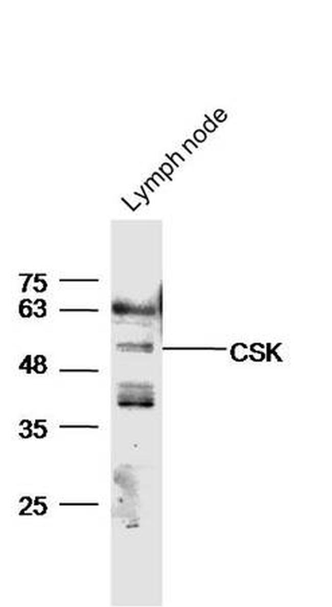 CSK Antibody in Western Blot (WB)