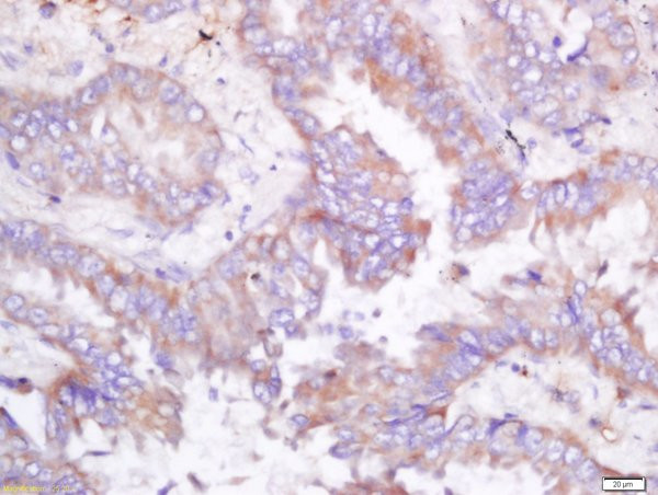 ODC Antibody in Immunohistochemistry (Paraffin) (IHC (P))