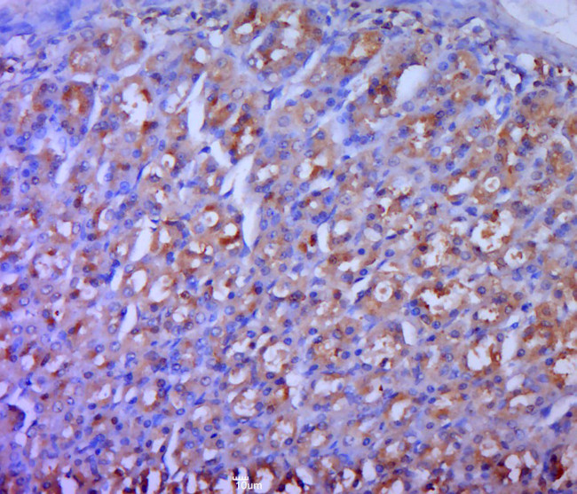 ODC Antibody in Immunohistochemistry (Paraffin) (IHC (P))