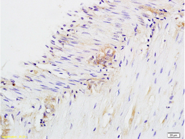 CD28 Antibody in Immunohistochemistry (Paraffin) (IHC (P))