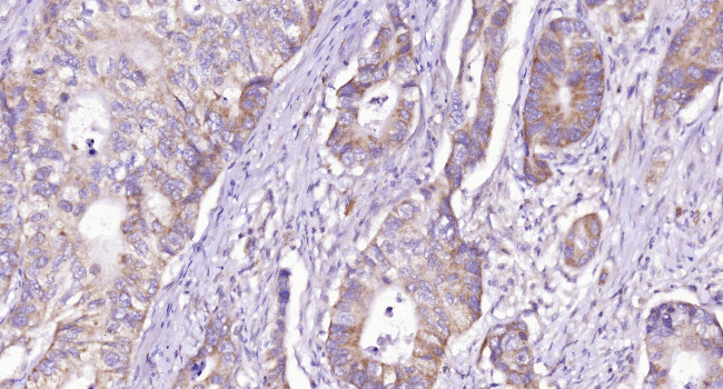 CD28 Antibody in Immunohistochemistry (Paraffin) (IHC (P))