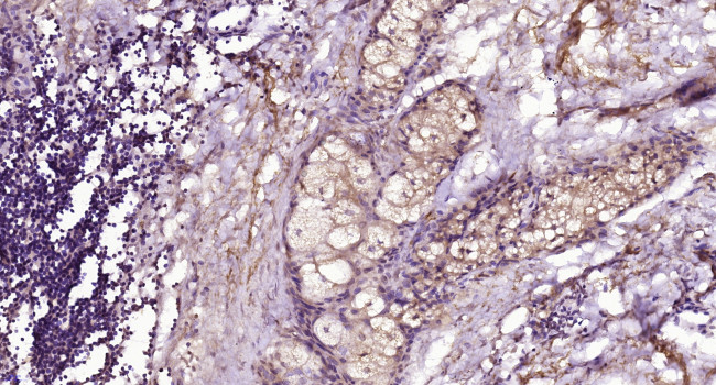 CD28 Antibody in Immunohistochemistry (Paraffin) (IHC (P))