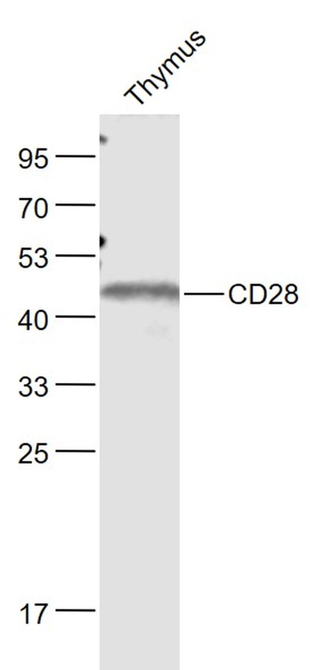 CD28 Antibody in Western Blot (WB)