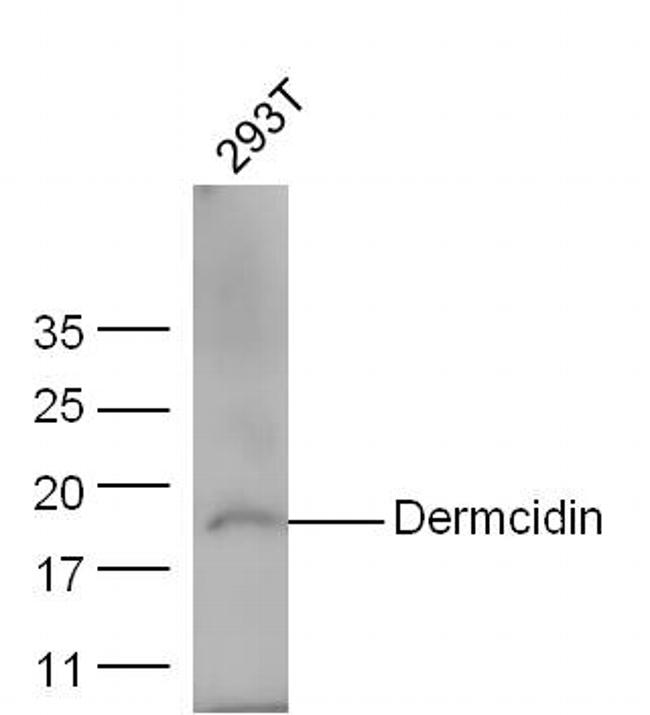 Dermcidin/DCD Antibody in Western Blot (WB)