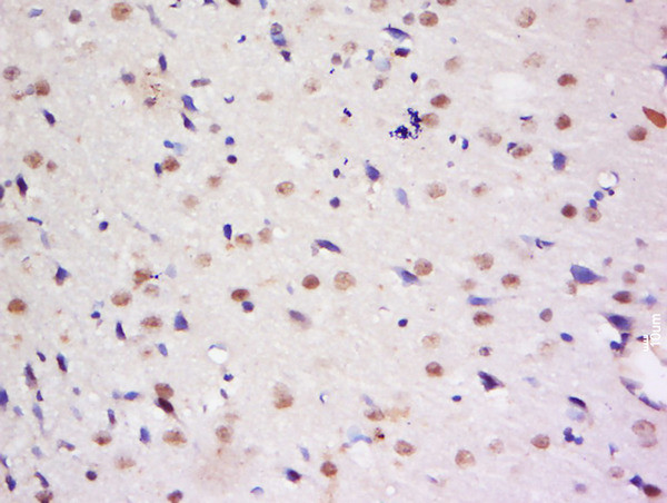 Dymeclin Antibody in Immunohistochemistry (Paraffin) (IHC (P))