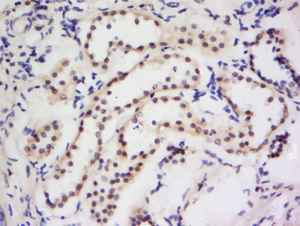 Dymeclin Antibody in Immunohistochemistry (Paraffin) (IHC (P))