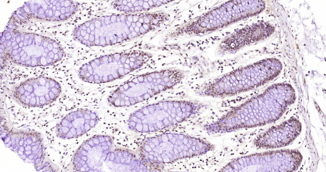 EBP1 Antibody in Immunohistochemistry (Paraffin) (IHC (P))