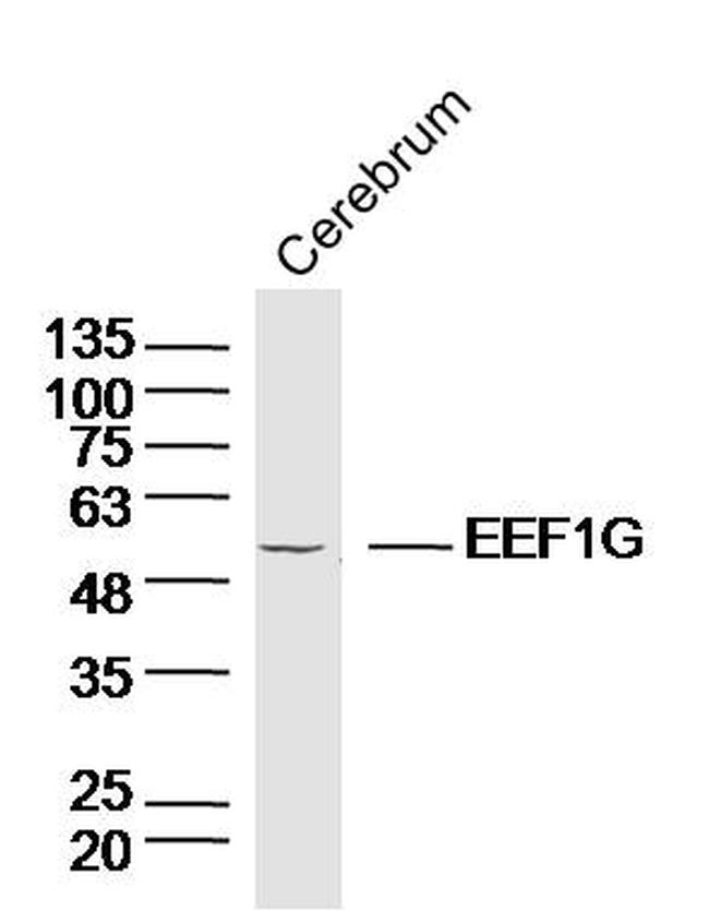 EEF1G Antibody in Western Blot (WB)