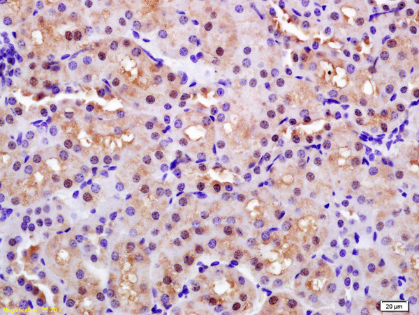 PARK7 Antibody in Immunohistochemistry (Paraffin) (IHC (P))