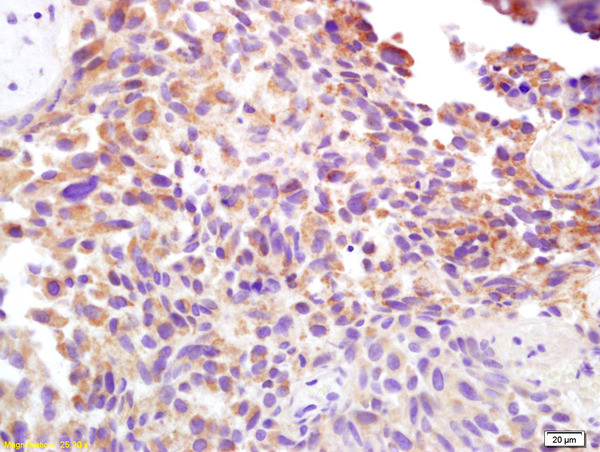 CD138/Syndecan 1 Antibody in Immunohistochemistry (Paraffin) (IHC (P))