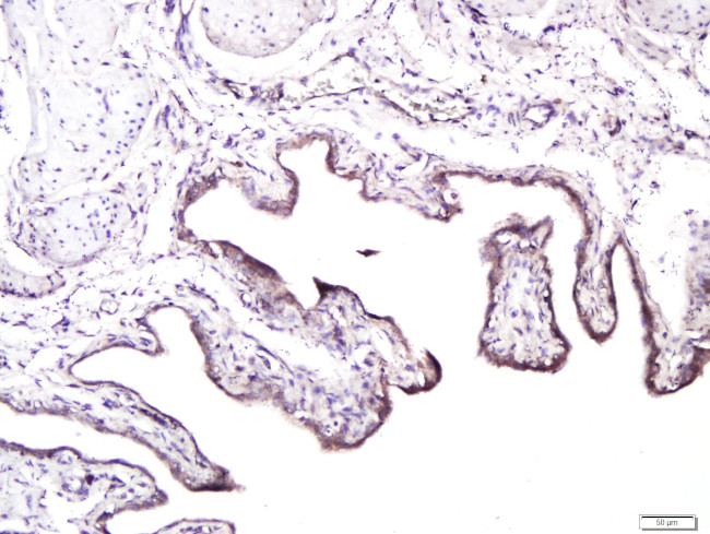 CD138/Syndecan 1 Antibody in Immunohistochemistry (Paraffin) (IHC (P))