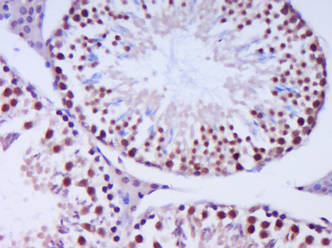 Exonuclease 1 Antibody in Immunohistochemistry (Paraffin) (IHC (P))