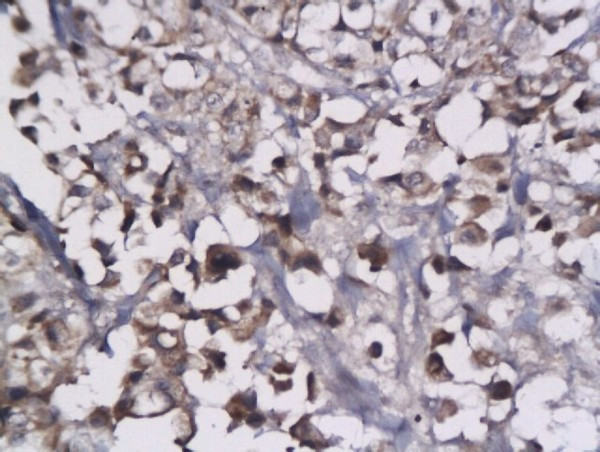 LYVE-1 Antibody in Immunohistochemistry (Paraffin) (IHC (P))