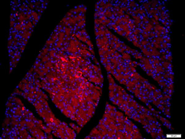 FAM134B Antibody in Immunohistochemistry (Paraffin) (IHC (P))