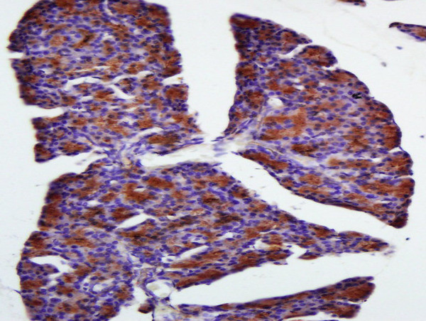 FAM134B Antibody in Immunohistochemistry (Paraffin) (IHC (P))