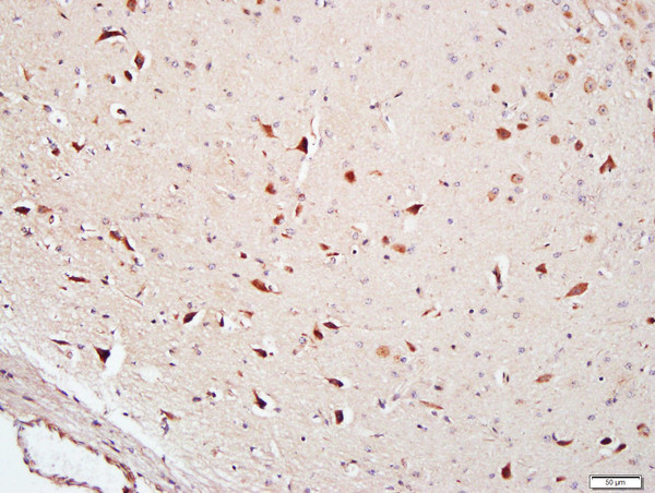 FAM134B Antibody in Immunohistochemistry (Paraffin) (IHC (P))