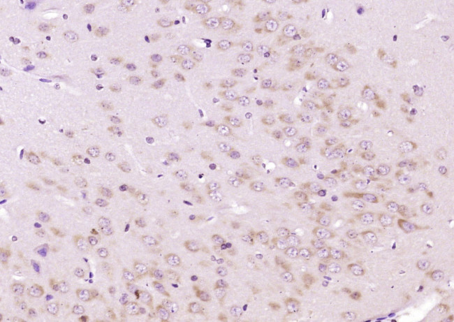 FBXO45 Antibody in Immunohistochemistry (Paraffin) (IHC (P))