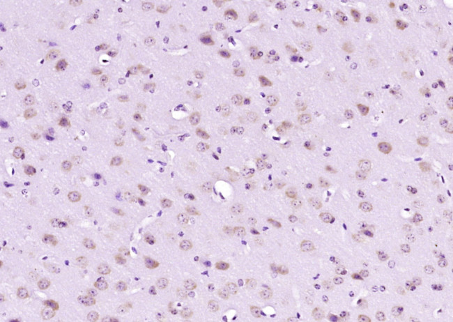 FBXO45 Antibody in Immunohistochemistry (Paraffin) (IHC (P))