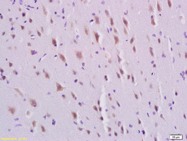 PDGFBB Antibody in Immunohistochemistry (Paraffin) (IHC (P))