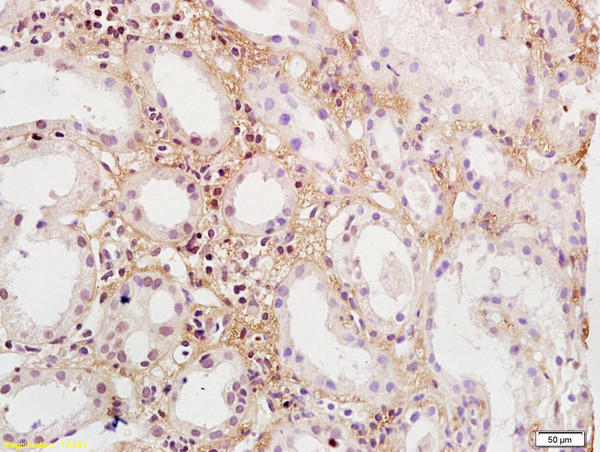 PDGFBB Antibody in Immunohistochemistry (Paraffin) (IHC (P))