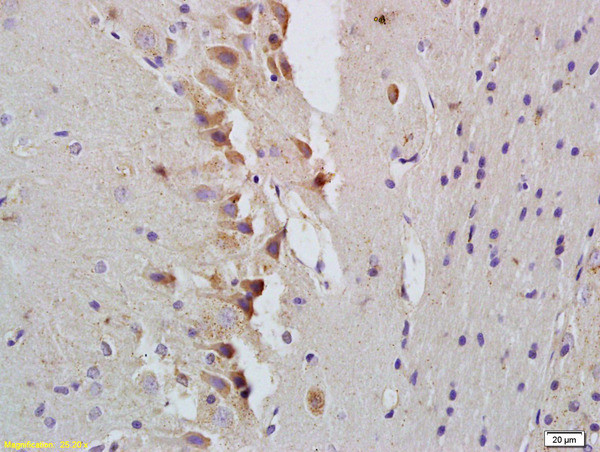 STAT1 Antibody in Immunohistochemistry (Paraffin) (IHC (P))