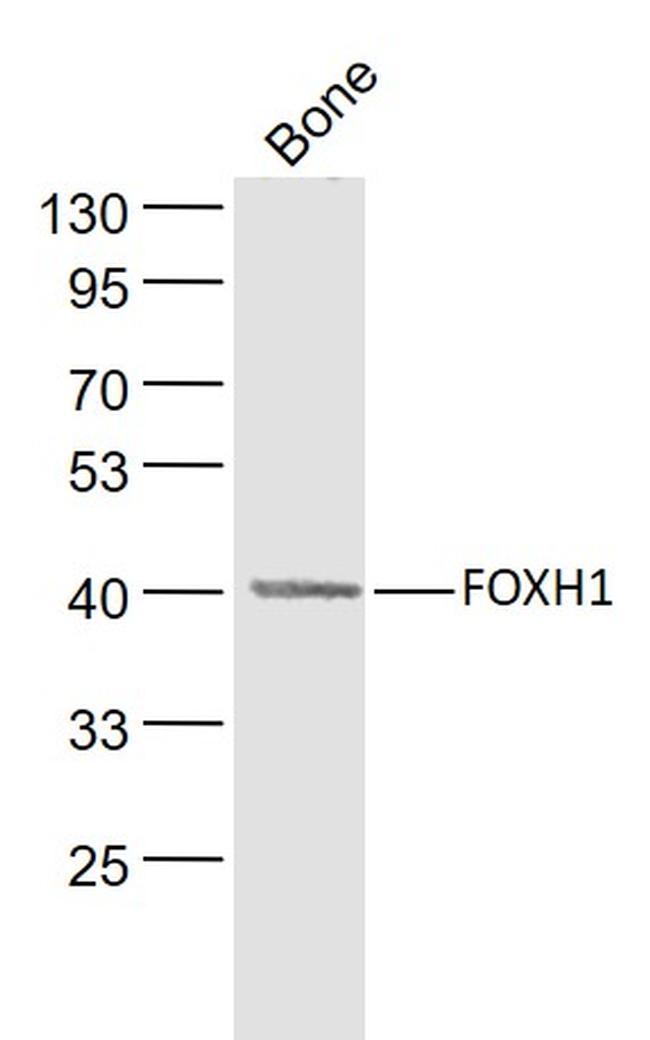 FOXH1 Antibody in Western Blot (WB)