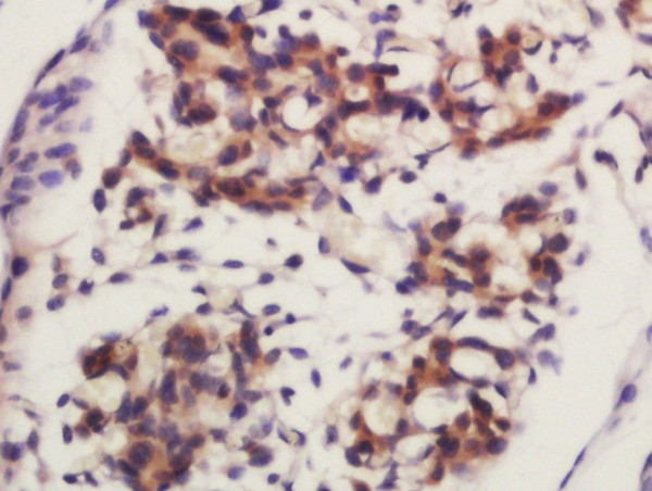 Frizzled 4/CD344 Antibody in Immunohistochemistry (Paraffin) (IHC (P))