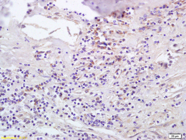 CCL5/RANTES Antibody in Immunohistochemistry (Paraffin) (IHC (P))