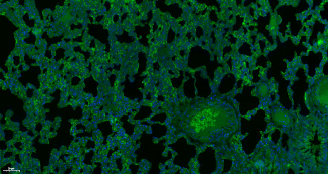 GAA Antibody in Immunohistochemistry (Paraffin) (IHC (P))