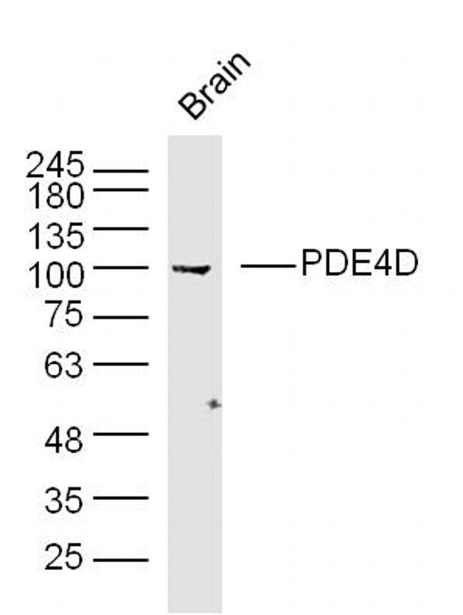 PDE4D Antibody in Western Blot (WB)