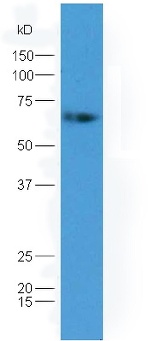 GAD65 + GAD67 Antibody in Western Blot (WB)