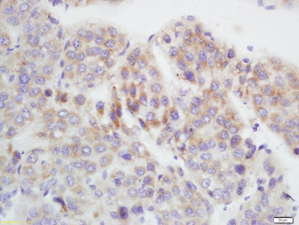 GAMT Antibody in Immunohistochemistry (Paraffin) (IHC (P))