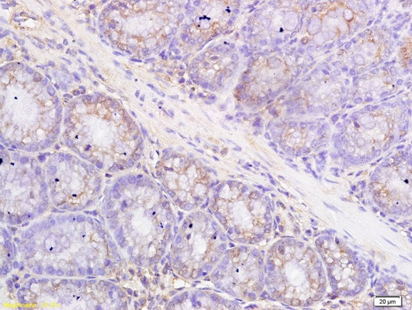 Metallothionein Antibody in Immunohistochemistry (Paraffin) (IHC (P))