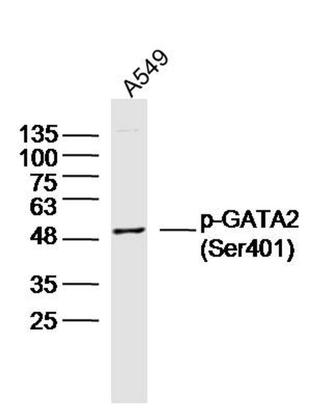 Phospho-GATA2 (Ser401) Antibody in Western Blot (WB)