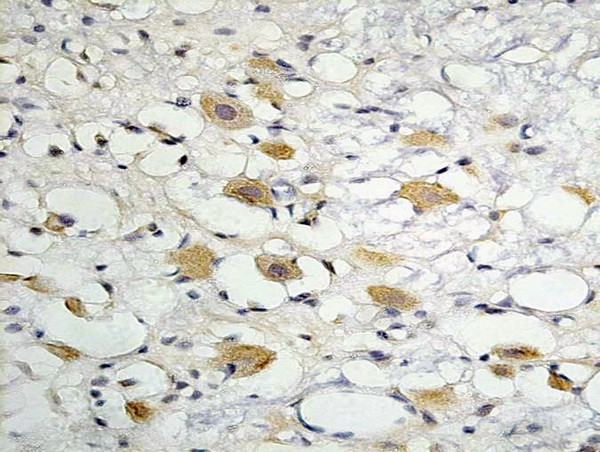 ZO-1 Antibody in Immunohistochemistry (Paraffin) (IHC (P))