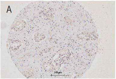 ZO-1 Antibody in Immunohistochemistry (Paraffin) (IHC (P))