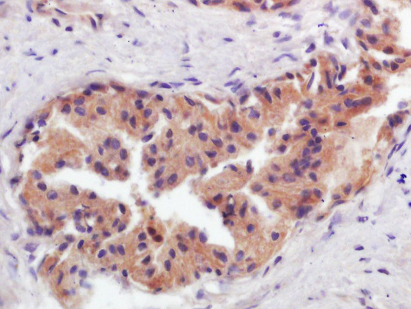 GCNT2 Antibody in Immunohistochemistry (Paraffin) (IHC (P))