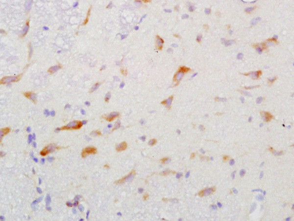 GGA2 Antibody in Immunohistochemistry (Paraffin) (IHC (P))