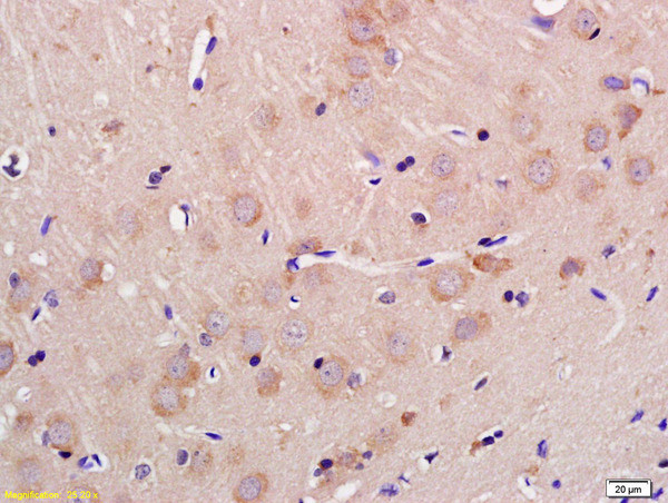 GLS2 Antibody in Immunohistochemistry (Paraffin) (IHC (P))