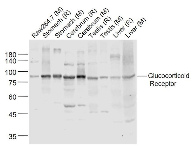 Glucocorticoid Receptor beta Antibody in Western Blot (WB)