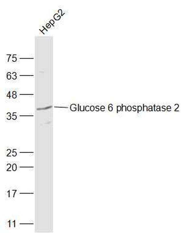 Glucose 6 phosphatase 2/IGRP Antibody in Western Blot (WB)