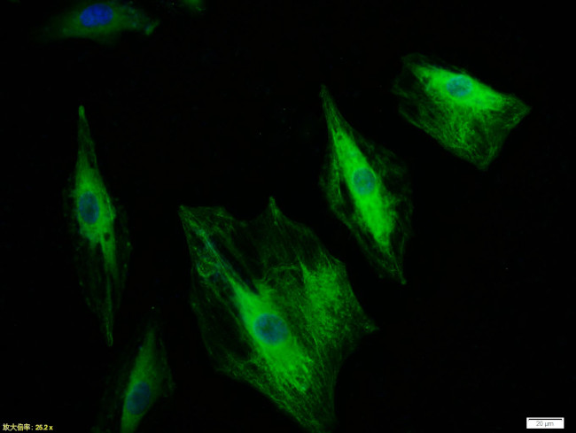 CK18 Antibody in Immunocytochemistry (ICC/IF)