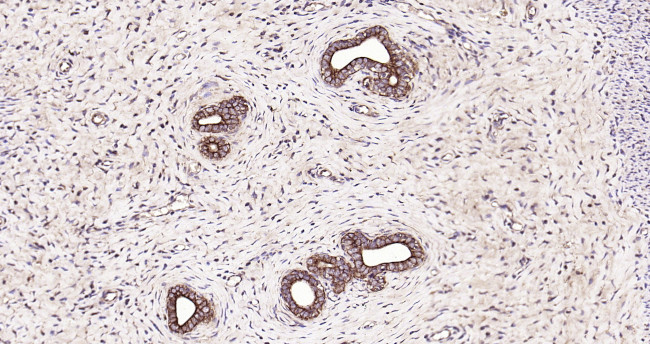 CK18 Antibody in Immunohistochemistry (Paraffin) (IHC (P))