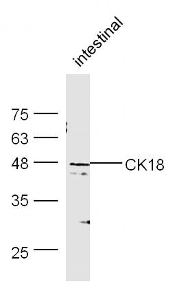 CK18 Antibody in Western Blot (WB)