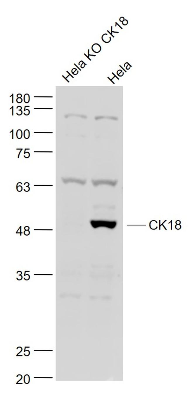 CK18 Antibody in Western Blot (WB)