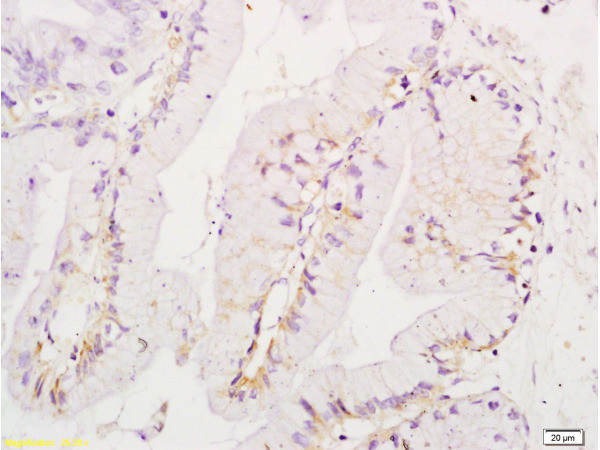 Ezrin Antibody in Immunohistochemistry (Paraffin) (IHC (P))