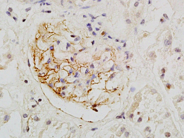 Podocalyxin Antibody in Immunohistochemistry (Paraffin) (IHC (P))