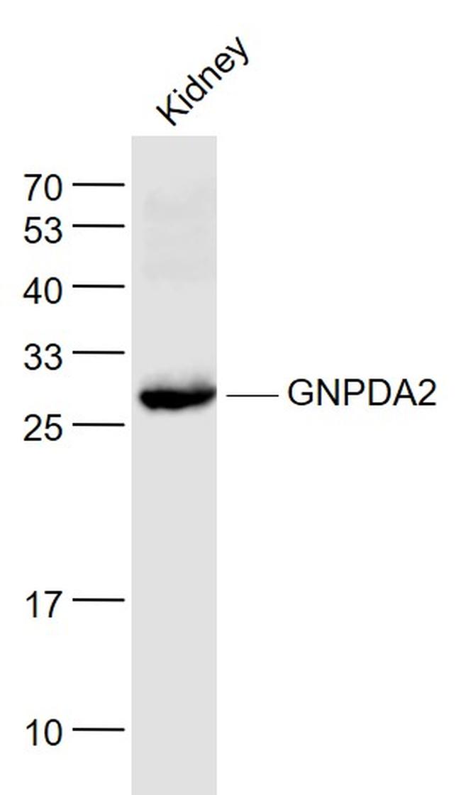 GNPDA2 Antibody in Western Blot (WB)